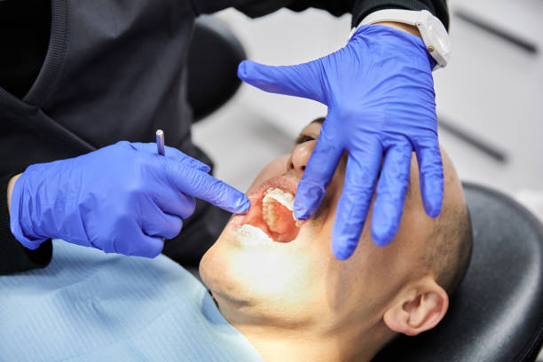 Best Dentist for Tooth Abscess  in Hollywood, SC